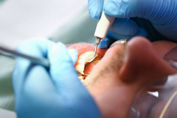 Best Emergency Tooth Extraction in Waveland, MS