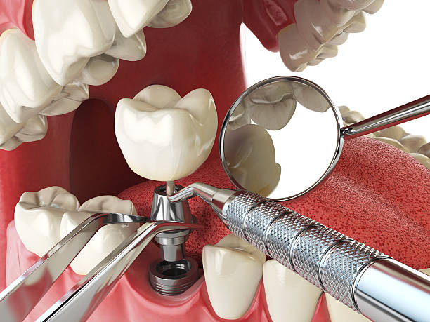 Best After-Hours Emergency Dentist in Waveland, MS
