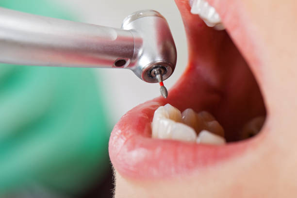 Best Emergency Treatment for Toothache in Waveland, MS